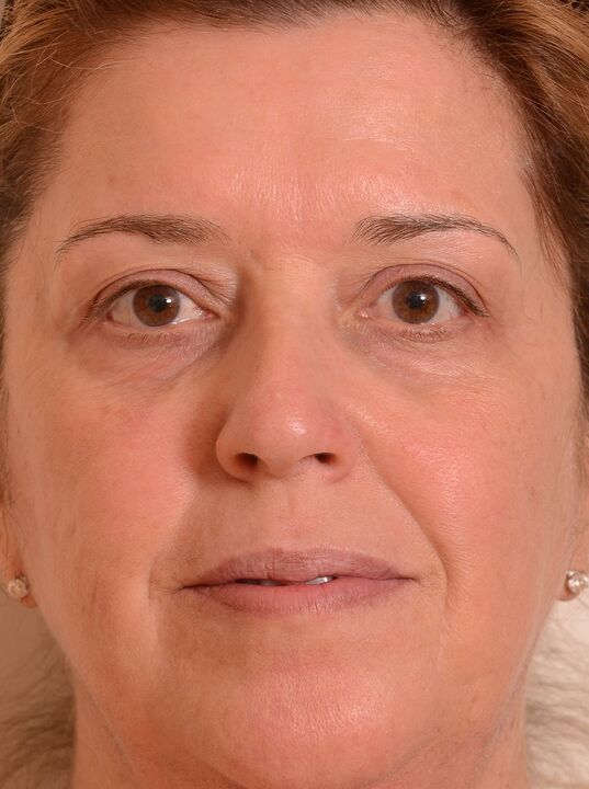 Rexuvenecín a cara con eudalie crema