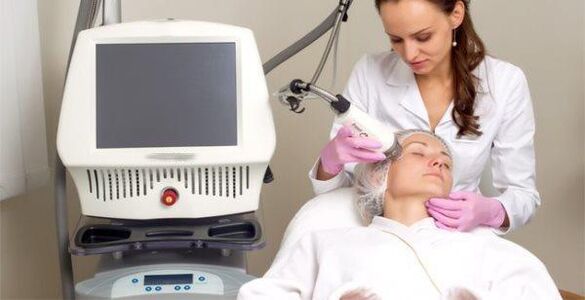 Implementación do procedemento