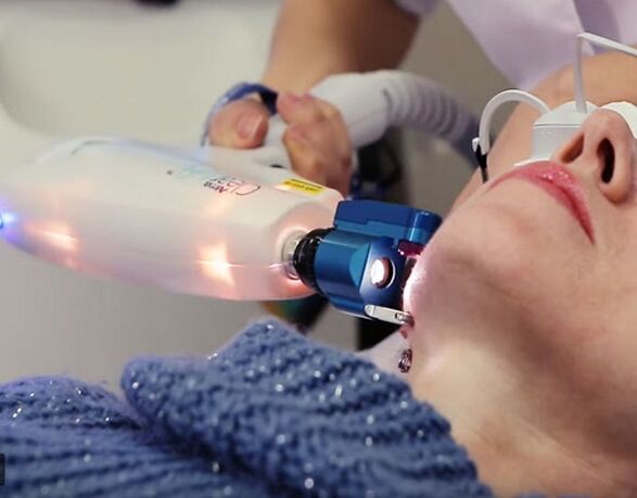 Loita contra as manchas da pel